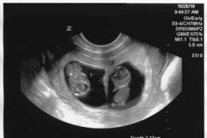 Why is an ultrasound performed in the seventh to ninth week of pregnancy?